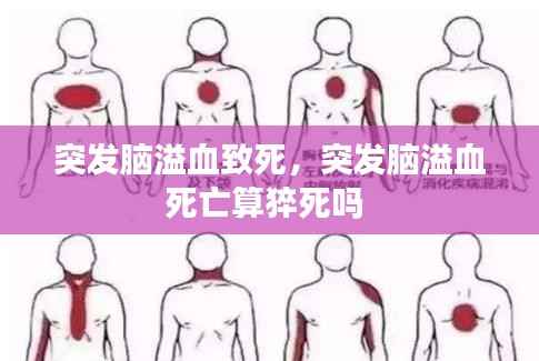 突发脑溢血致死,突发脑溢血死亡算猝死吗