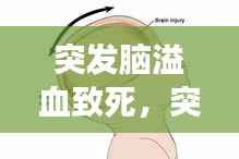 突发脑溢血致死,突发脑溢血死亡算猝死吗