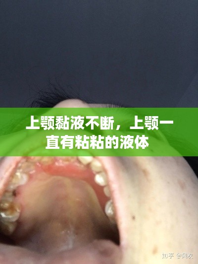 上颚黏液不断,上颚一直有粘粘的液体