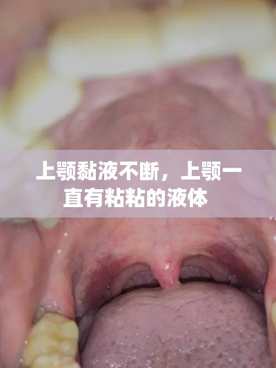 上颚黏液不断,上颚一直有粘粘的液体