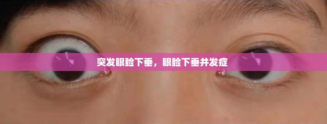 突发眼睑下垂,眼睑下垂并发症